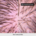 L'ORÉAL PROFESSIONNEL PARIS | TRAITEMENT PROFESSIONNEL APAISANT INTENSE POUR CUIR CHEVELU SENSIBLE | SERIE EXPERT | SCALP ADVANCED | 200 ML – Image 3