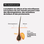 L'ORÉAL PROFESSIONNEL PARIS | TRAITEMENT PROFESSIONNEL APAISANT INTENSE POUR CUIR CHEVELU SENSIBLE | SERIE EXPERT | SCALP ADVANCED | 200 ML – Image 5